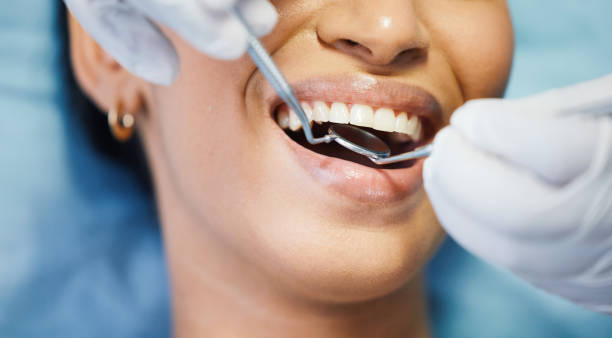 Best Holiday Emergency Dentist in Huntington, UT